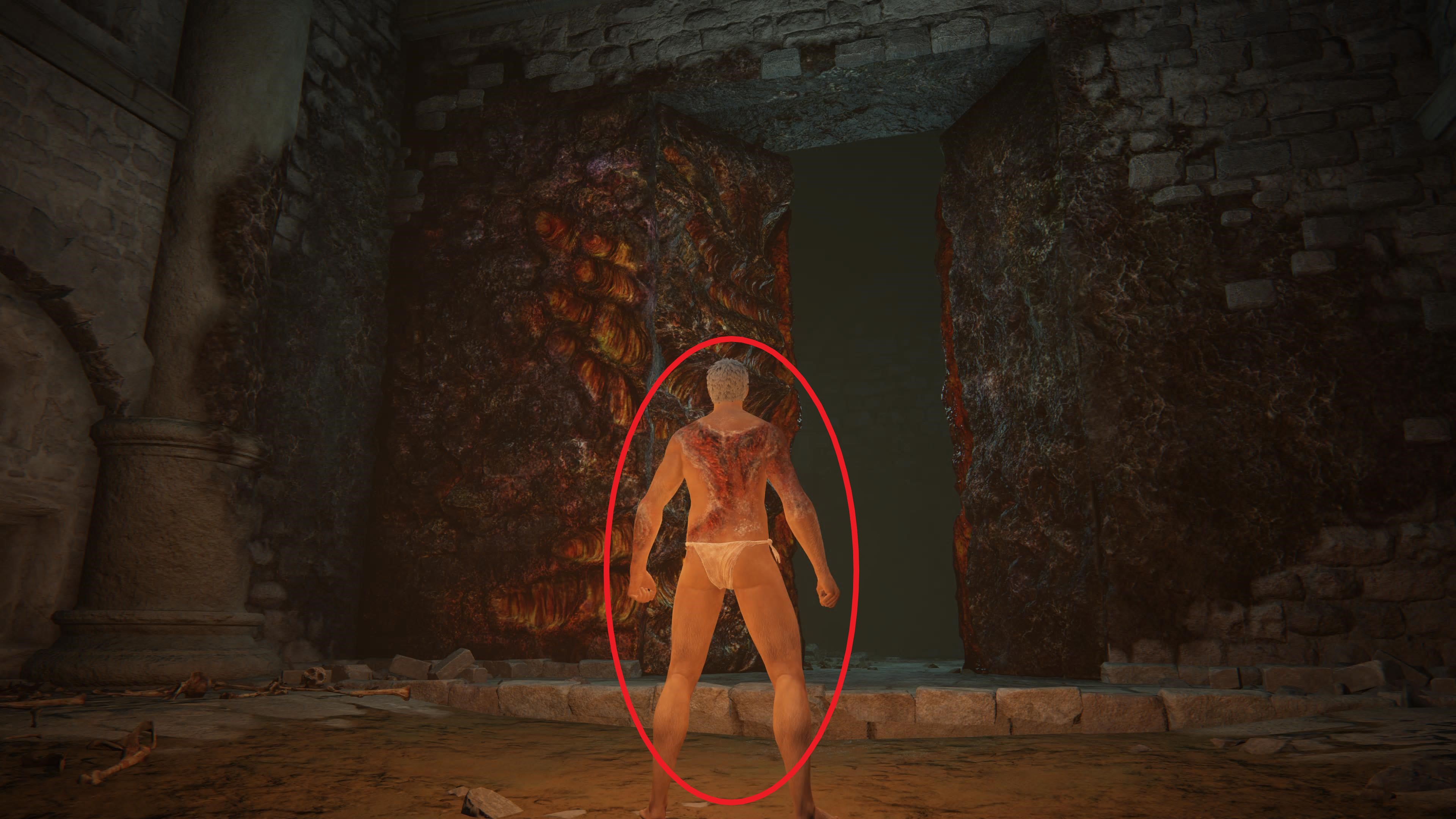 Elden%20Ring%20-%20Brandwunden%20Hinten.