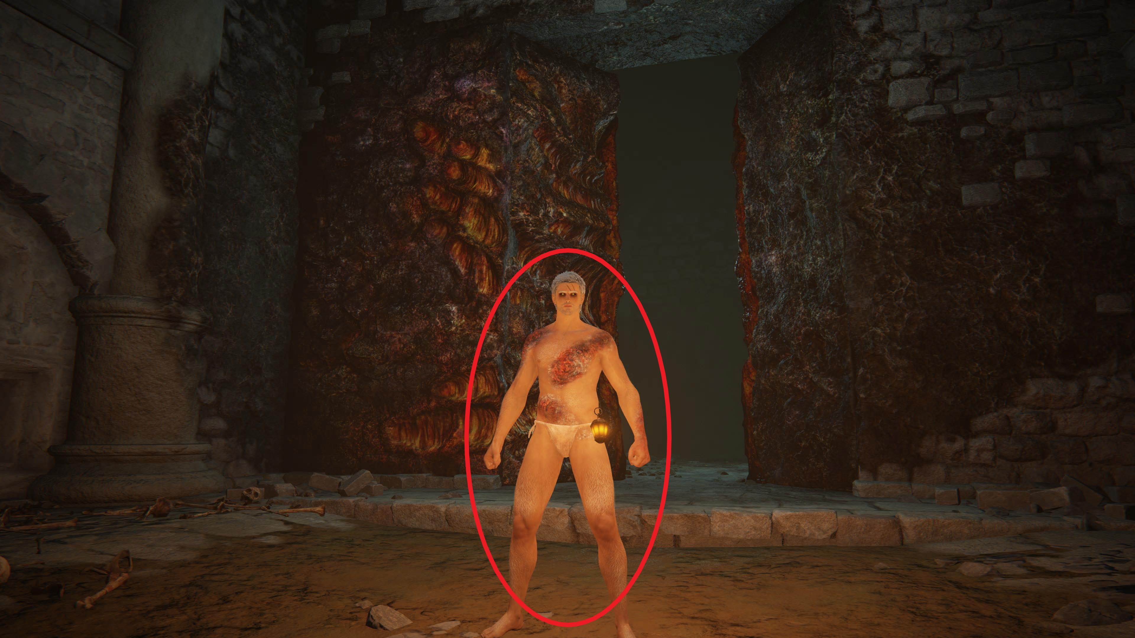 Elden%20Ring%20-%20Brandwunden%20Vorne.j